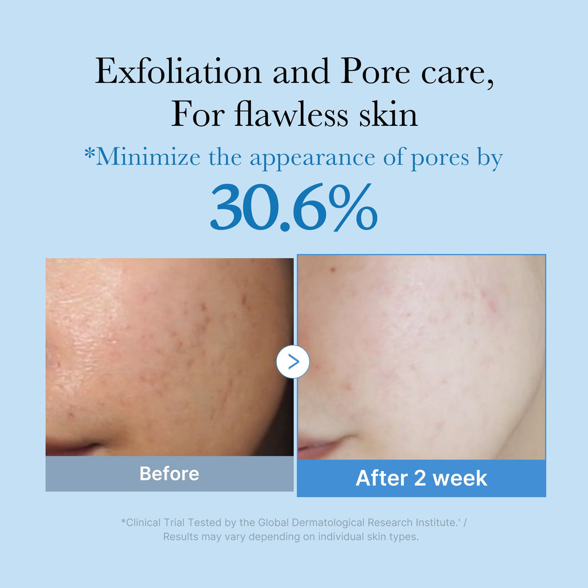 zero-pore-toner-q5 01_d6480b4e-3c08-4954-994a-ed5212c1839c.jpg