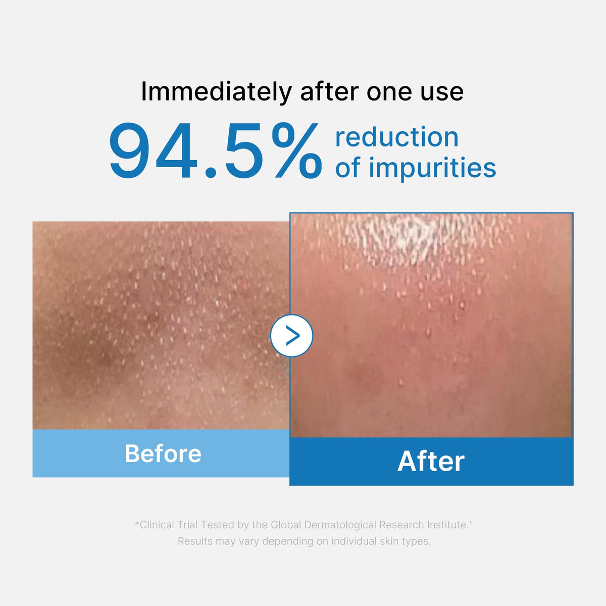 zero-pore-blackhead-deep-cleansing-oil-h7 01_eed557ec-5857-46a2-8b17-dbd67c692dcb.jpg