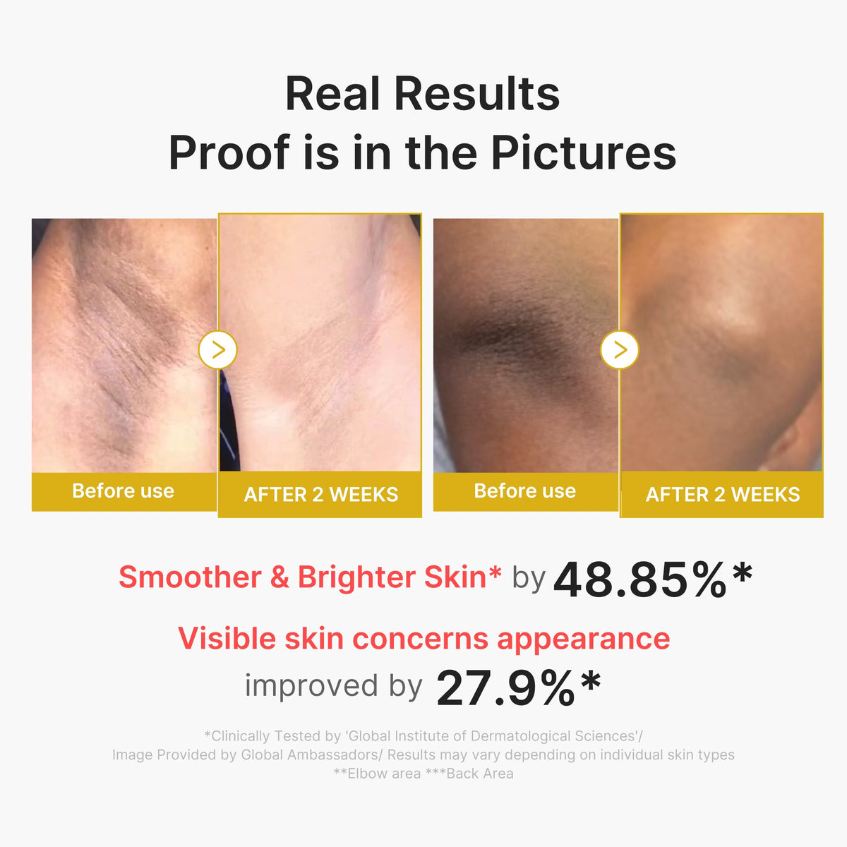kojic-acid-turmeric-body-peel-shot-s1 02_72880cfc-382b-440b-8152-7e3dce87da2a.jpg