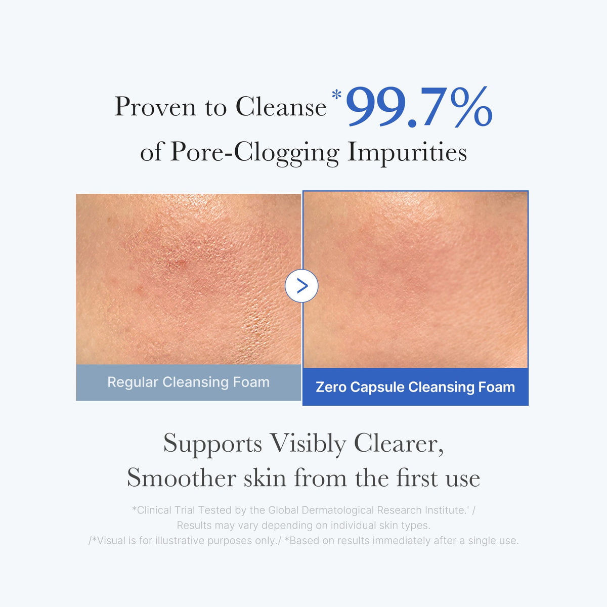 zero-pore-capsule-cleansing-foam-g7 02_c1fb9dfb-86c5-4038-8ff8-490d1006276c.jpg