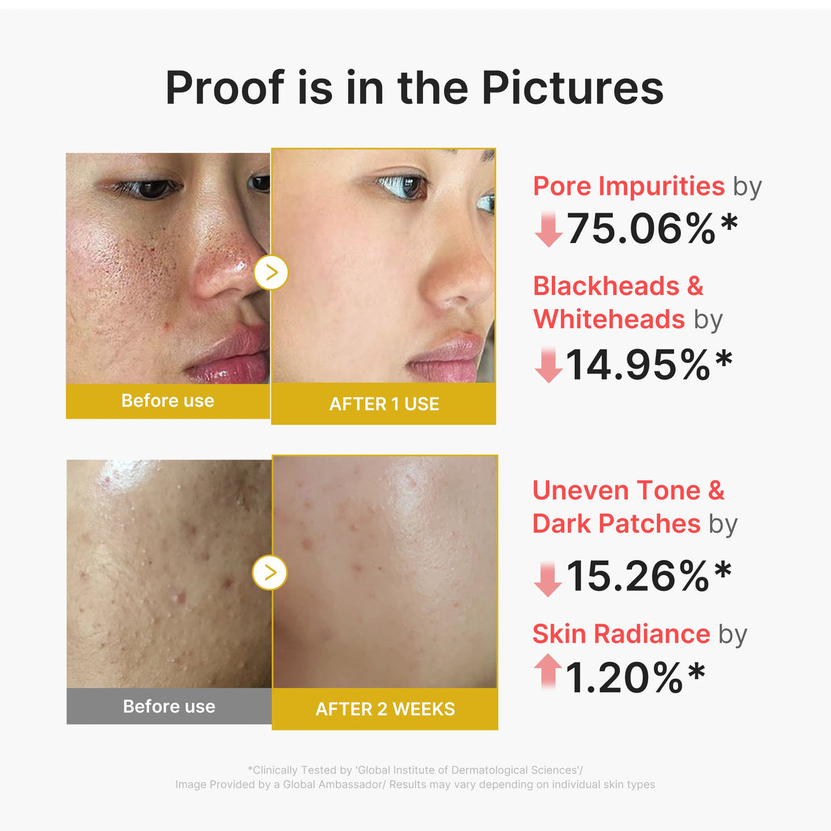 kojic-acid-turmeric-peel-shot-o7 02_45fe66d3-b3f6-4100-aa52-2afd7eded417.jpg