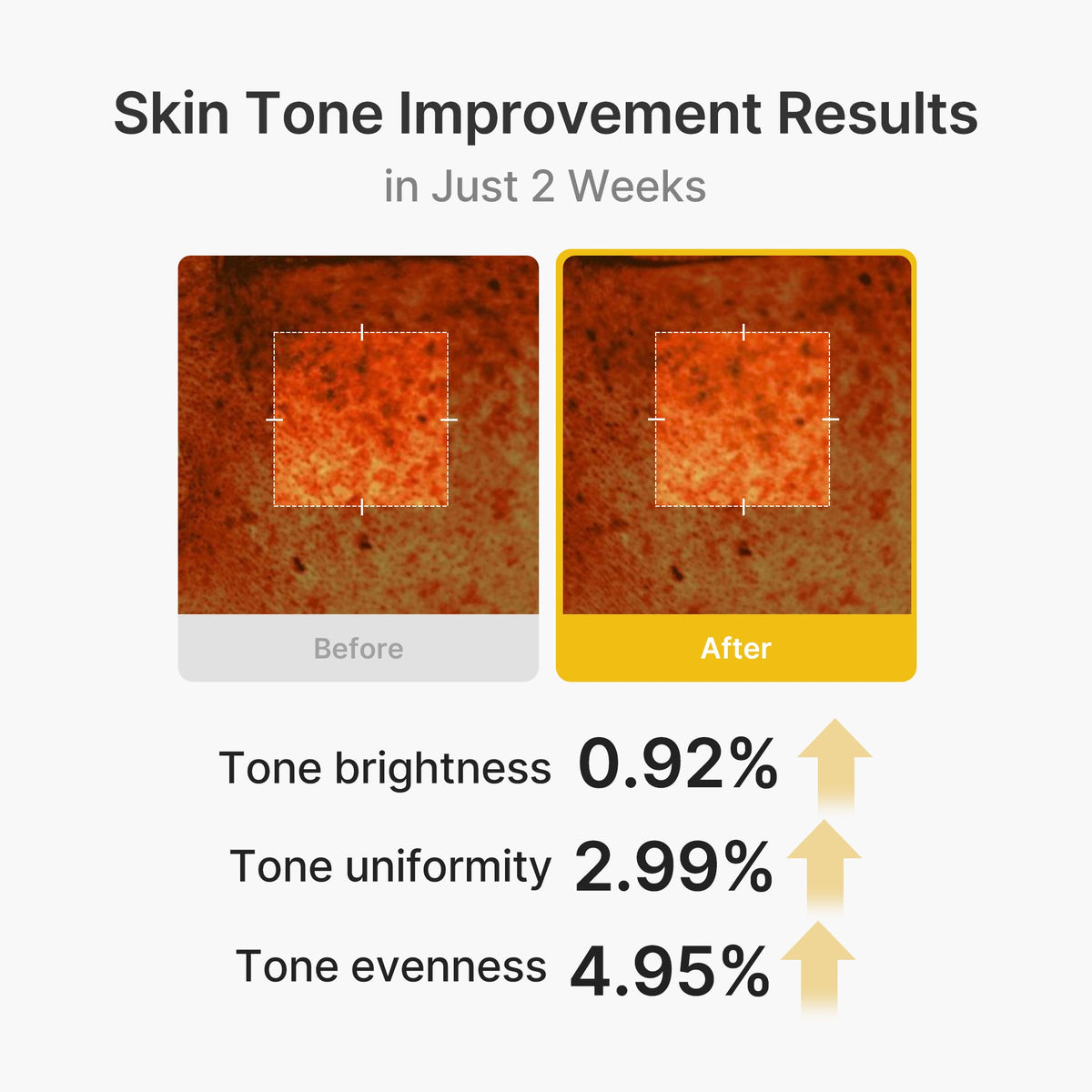 kojic-acid-turmeric-vita-capsule-cream-u7 03_2b626701-fc6c-4702-9e96-a2157a4f7f9d.jpg