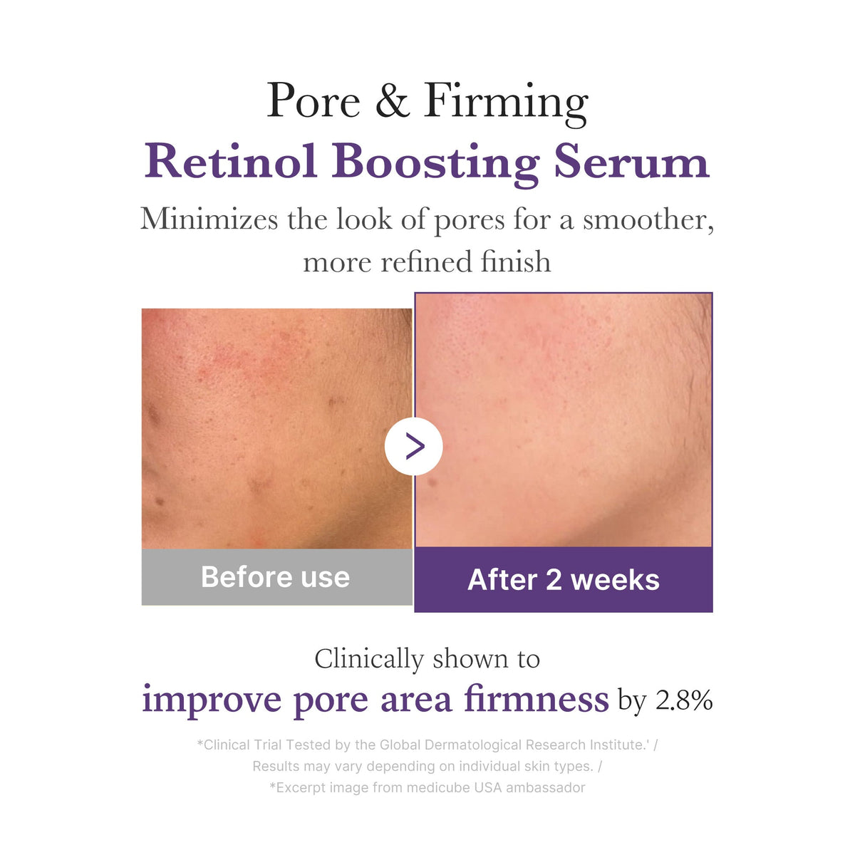 retinol-nmn-boosting-serum-v9 03_3510e7a5-5633-4a18-81ea-1389593bd517.jpg