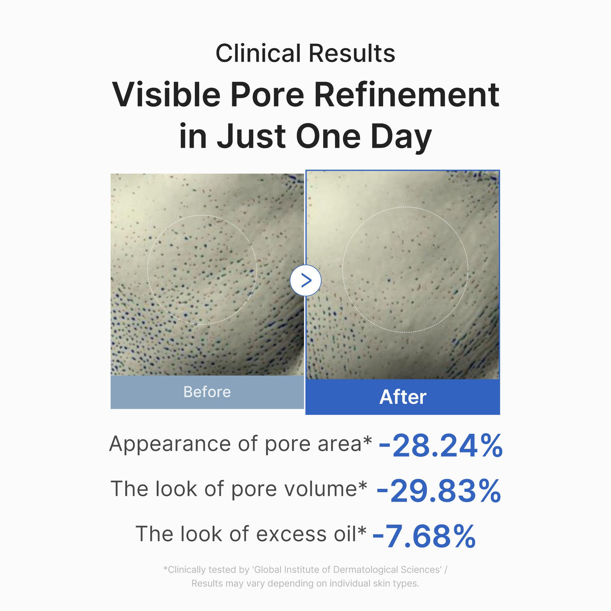 zero-pore-one-day-peptide-serum-a6 03_448eab9e-dc60-4dcb-9e4e-e863aabb61b0.jpg
