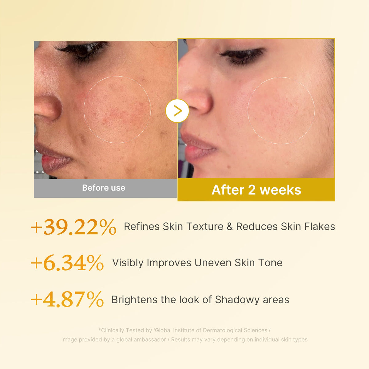 kojic-acid-turmeric-toner-g8 03_b7578d52-4c93-4407-9c6c-7cb230c85b06.jpg