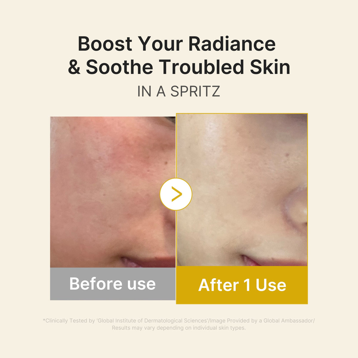 kojic-acid-turmeric-vitamin-gold-jelly-mist-serum-p9 03_dc9cd19e-4e57-49d3-9b66-c7762e8a63f1.jpg