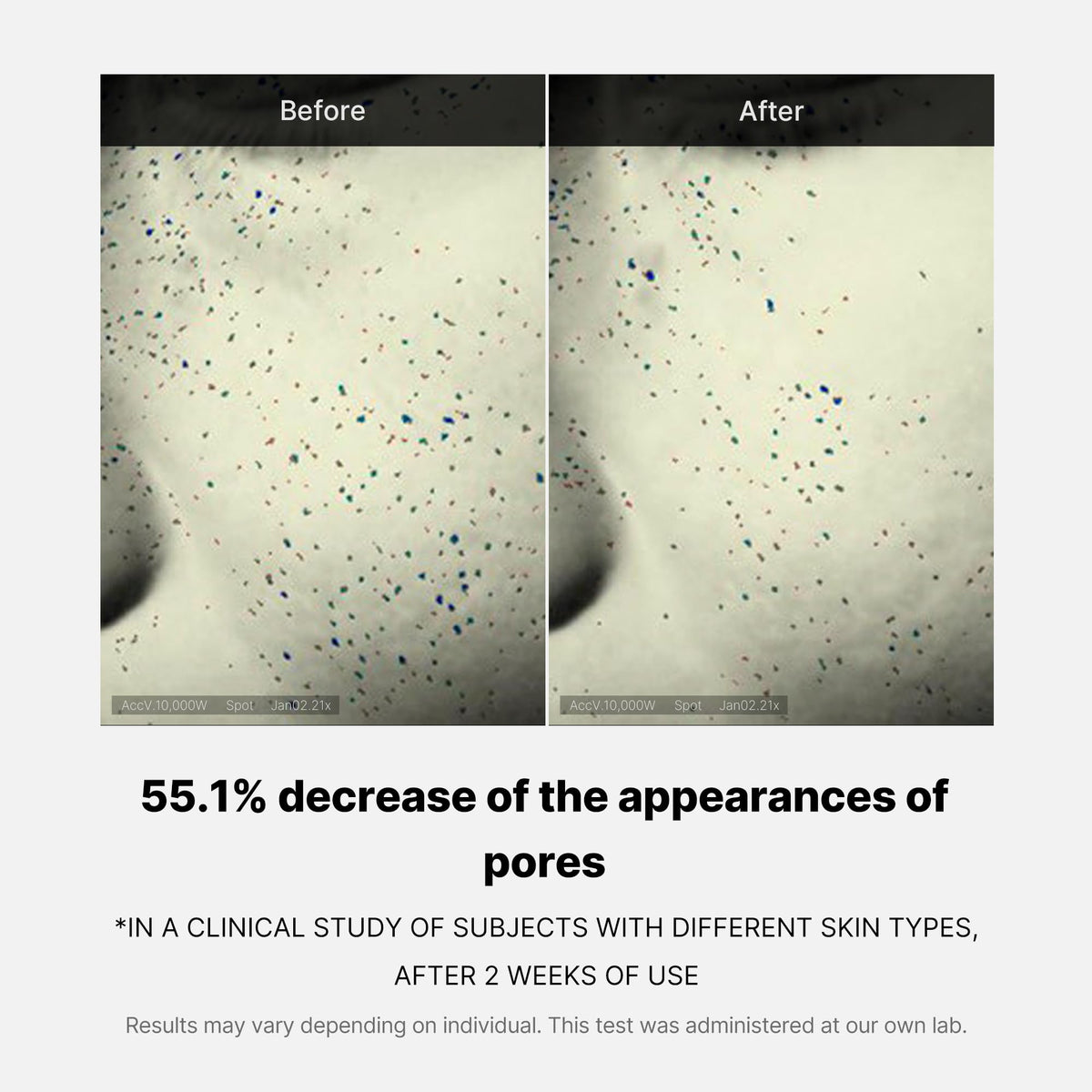 zero-pore-one-day-cream-u1 04_3616addc-f184-4deb-a5d7-e3a782e4713d.jpg