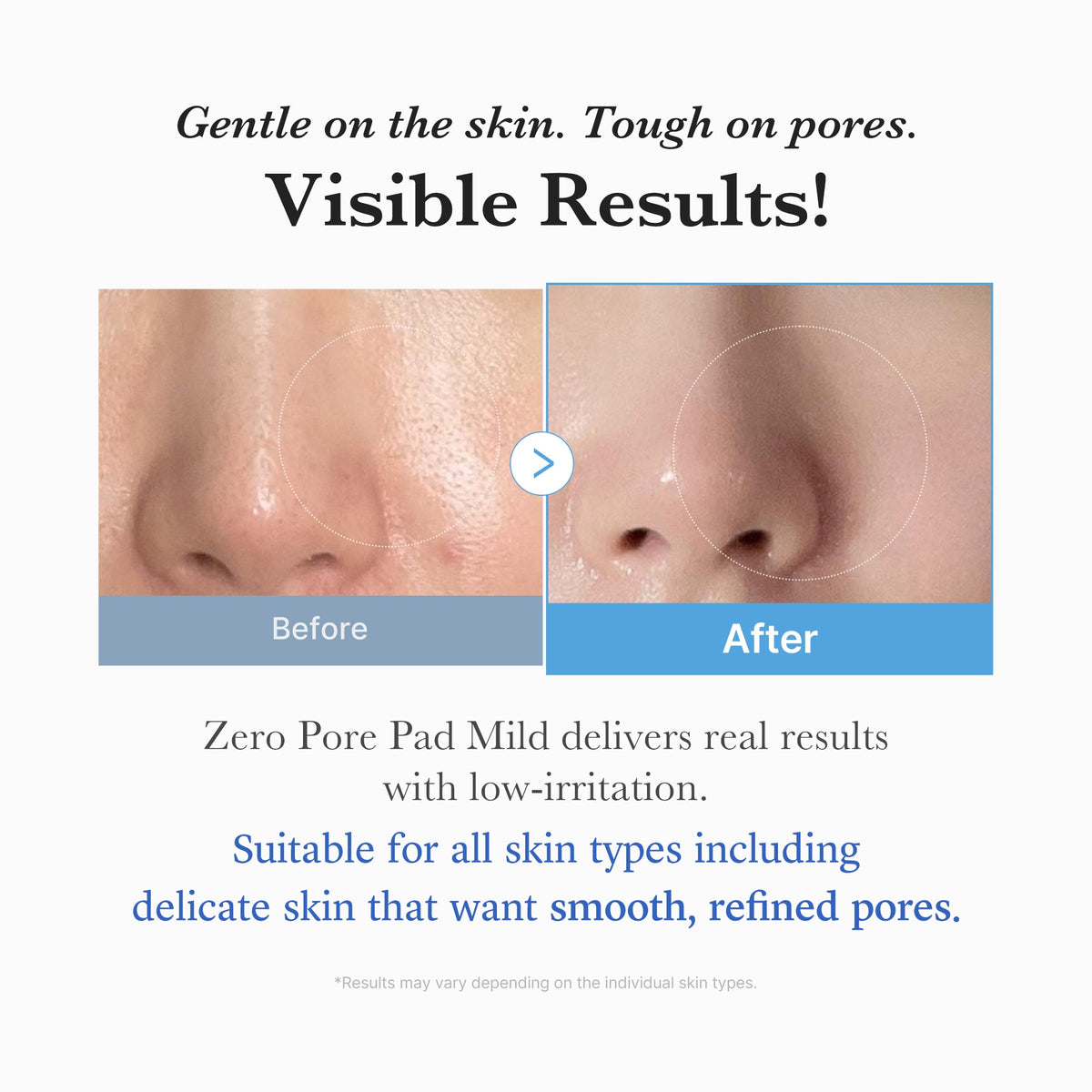 zero-pore-madecassoside-pads-mild-z2 04_6357f9f9-483b-4891-82c6-a58d336e62c8.jpg