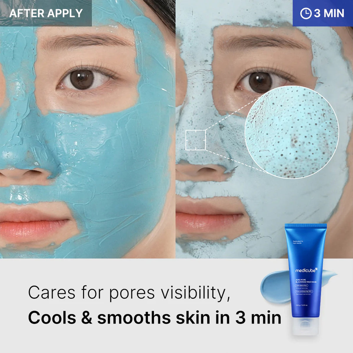 zero-pore-blackhead-mud-mask-j0 04_867c0459-a94e-40d3-bd9a-70400edabe8d.jpg