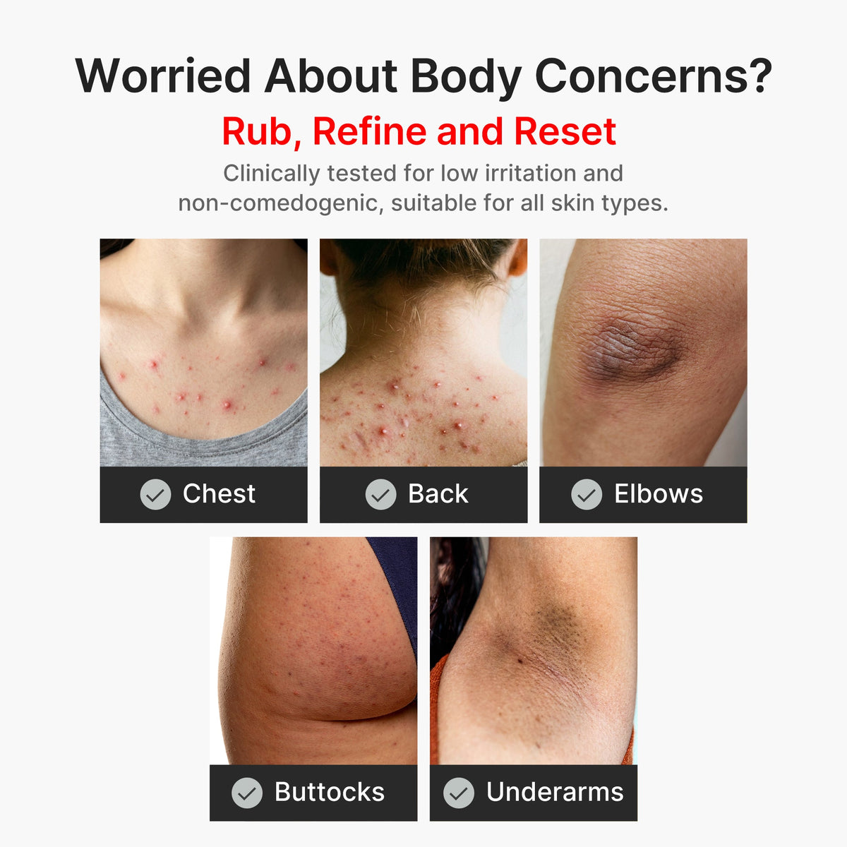 kojic-acid-turmeric-body-peel-shot-s1 04_8a7237f2-3ebf-401e-bd85-54841aeb3efc.jpg