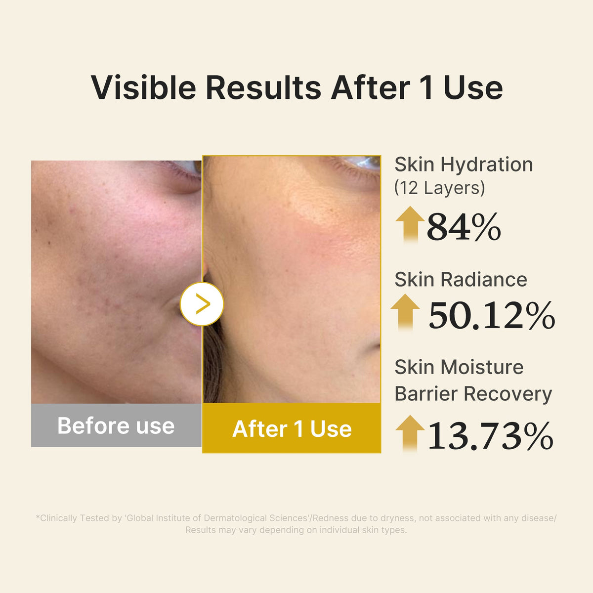 kojic-acid-turmeric-vitamin-gold-jelly-mist-serum-p9 04_d5c55ef1-e03b-494d-bc0d-a1ecc7fc2abf.jpg