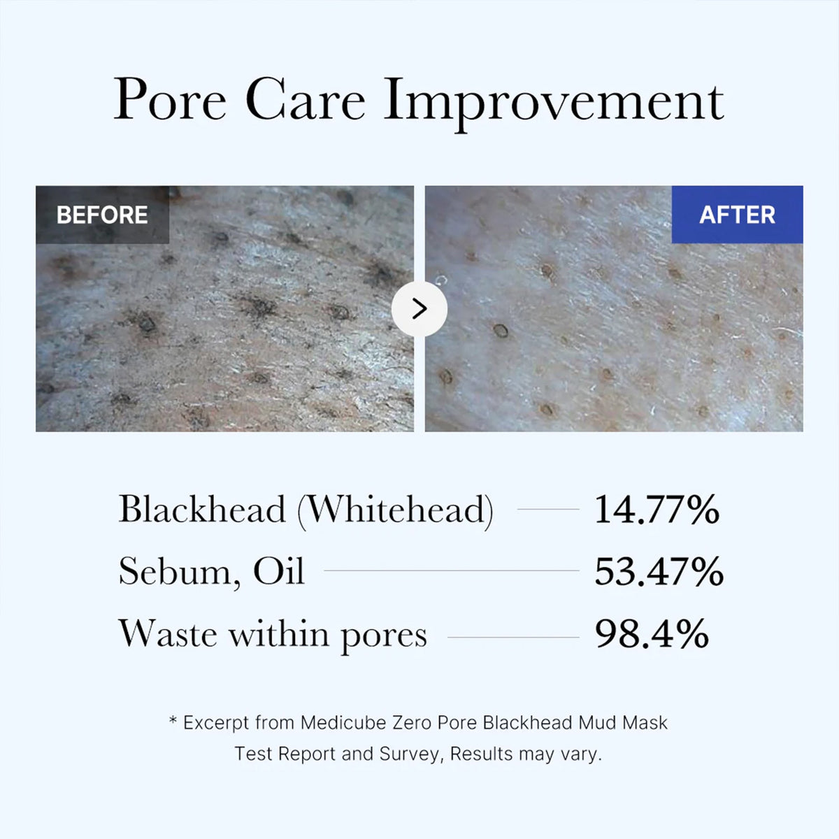 zero-pore-blackhead-mud-mask-j0 05_9362a158-c2b3-4525-acc0-631a2cfdea47.jpg