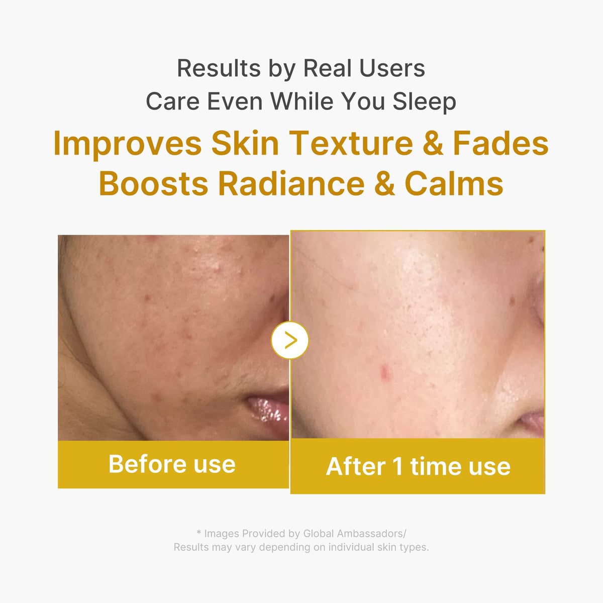 kojic-acid-turmeric-overnight-wrapping-mask-z0 2_04.jpg
