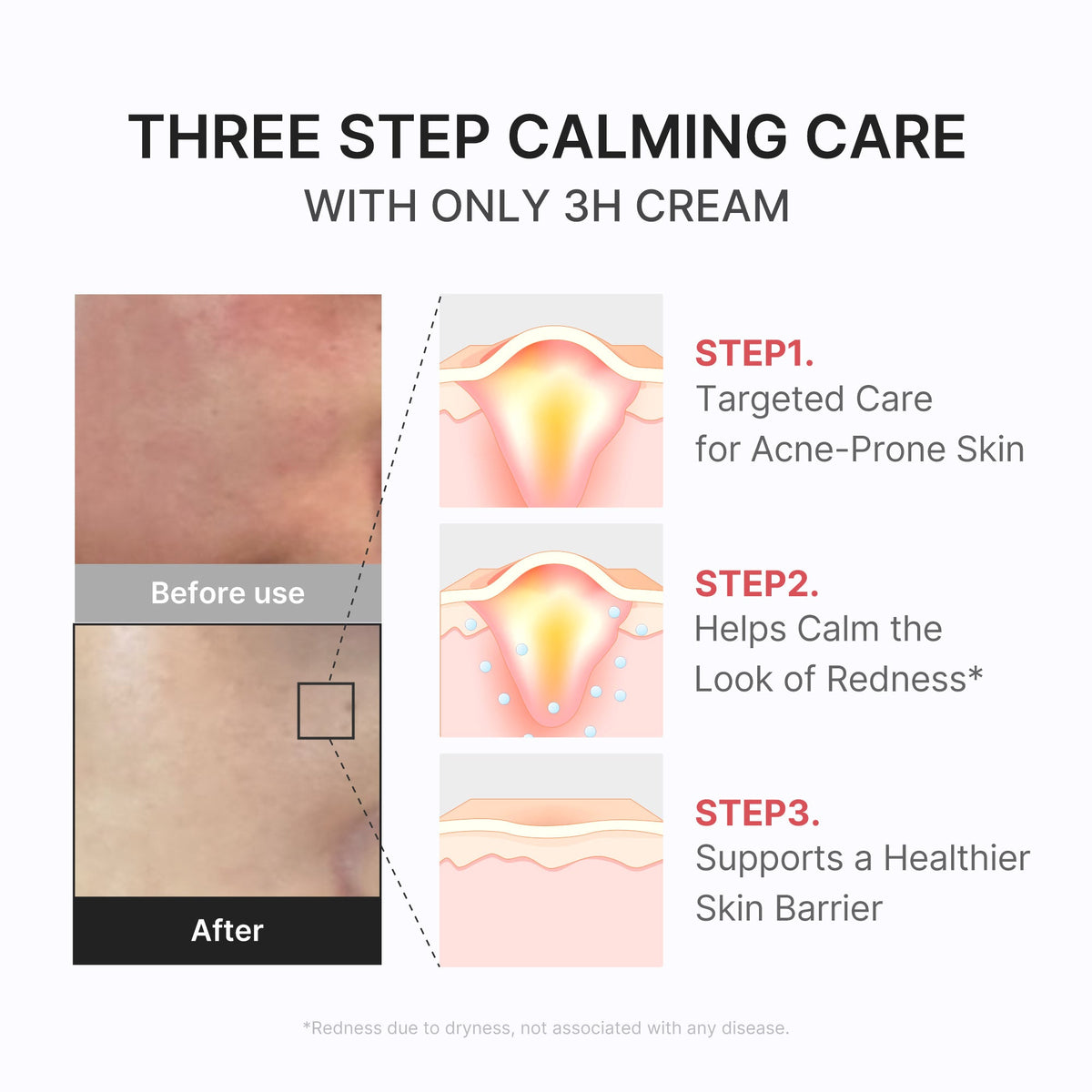 3h-daily-relief-cream-u4 3H_04.jpg