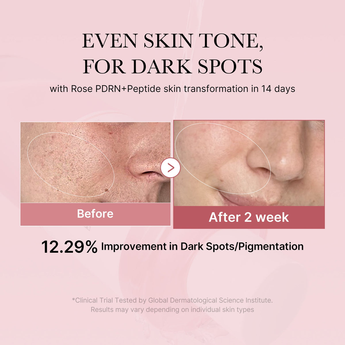 pdrn-pink-peptide-toner-y6 PDRN_01_308c518e-5ac6-4e54-99bd-eabc8796739b.jpg