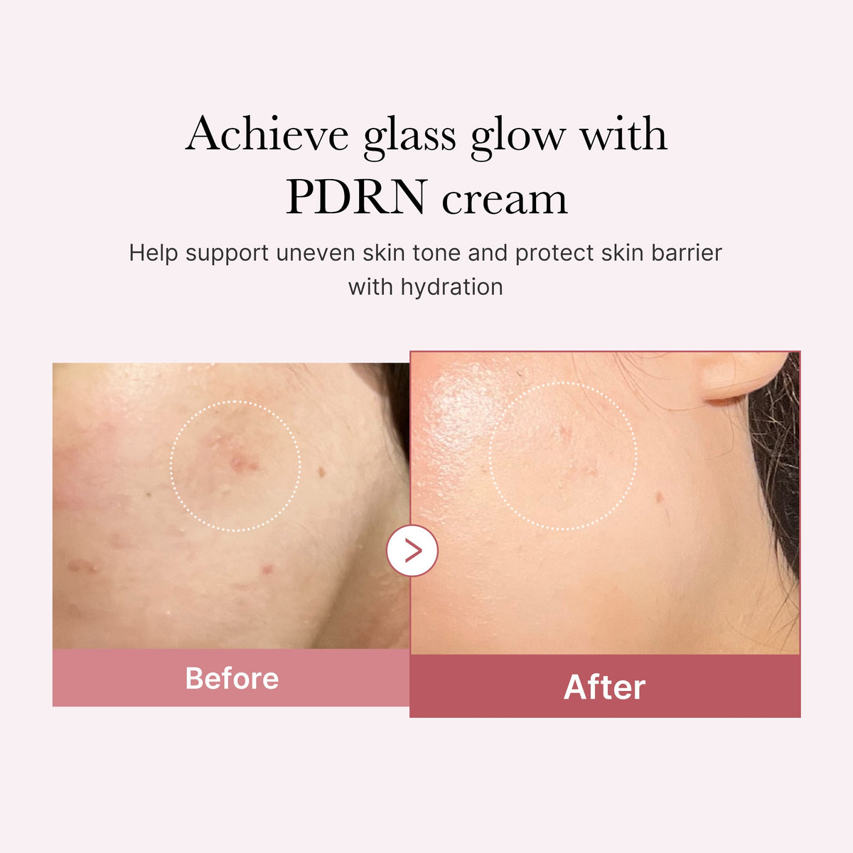 pdrn-pink-peptide-cream-o2 PDRN_02_d7805bfe-cf43-446a-b71b-a276683f136b.jpg
