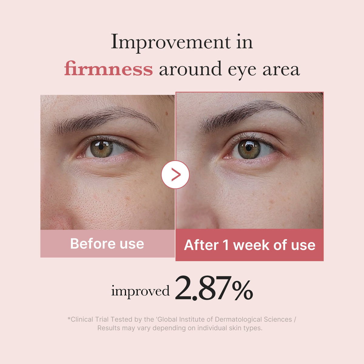 pdrn-pink-peptide-eye-cream-b3 PDRN_03_256dd753-0a2f-41b4-b3cd-bbfd3bc27018.jpg