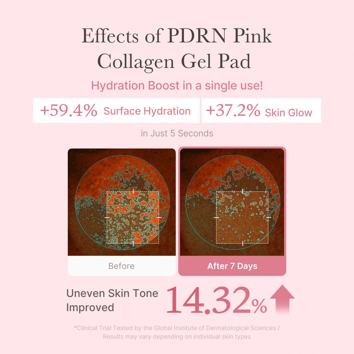 pdrn-pink-collagen-gel-toner-pad-e8 PDRN_04_f9a16a56-8d9e-4c47-a635-ed34ec3ed571.jpg