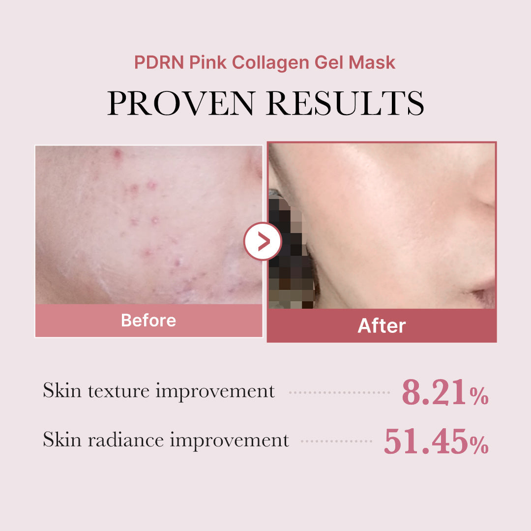 pdrn-pink-glow-full-set-m7 PDRN_12.jpg