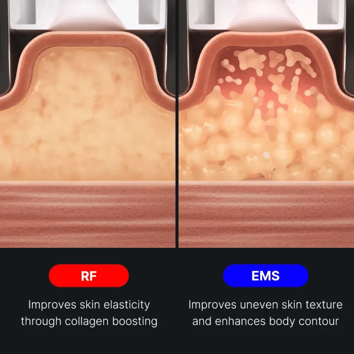 age-r-contour-body-shot-o1 img.webp